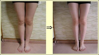 すぐに足が細くなるダイエットをお伝えます 太ももとお尻に悩んでいる人にオススメ イメージ1