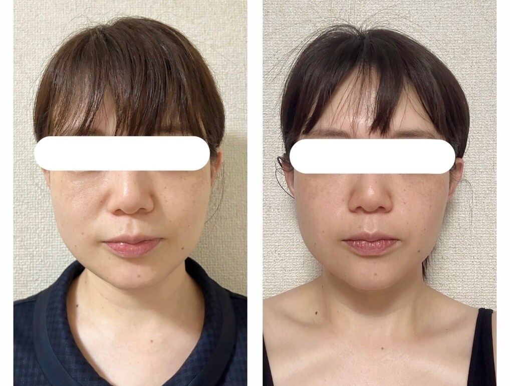 若返りケア教えます 美容医療に頼らないたるみ改善ケア イメージ3