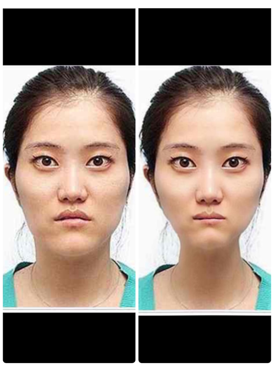 写真で整形体験をして頂けます 整形したいけど現実ではちょっと、、という方にオススメ イメージ2