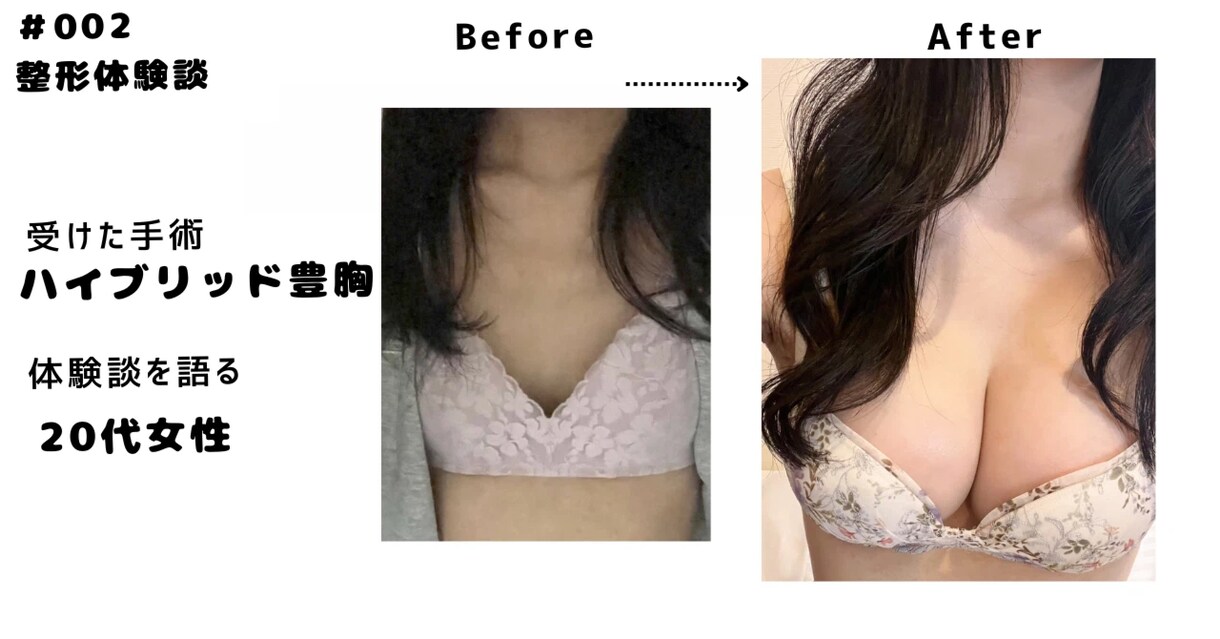 鼻整形の名医、修正医59名のリスト紹介します 現役美容外科社員がまとめる全国の鼻整形の名医・修正医リスト イメージ6
