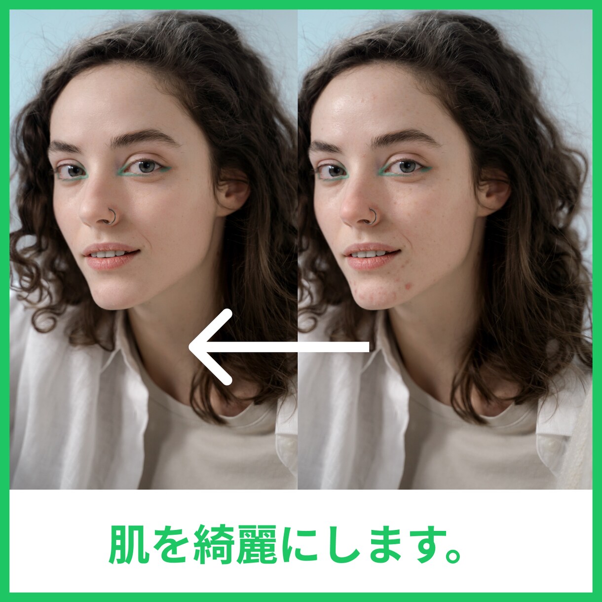 肌を綺麗にします 肌を綺麗にします。ニキビ、シミの修正など イメージ1