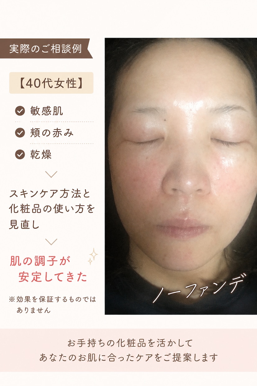 肌悩み改善 あなただけのスキンケアアドバイスします すっぴんに自信を持ちたい方へ あなただけのケア方法をご提案 イメージ2